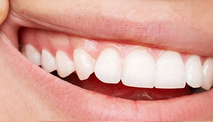 After treatment