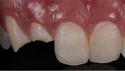 Before treatment