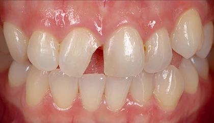 Before treatment