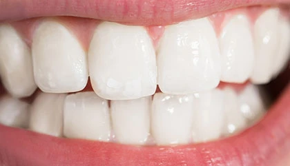 After whitening